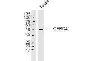 Mouse testis lysates probed with CERD4 Polyclonal Antibody, Unconjugated  at 1:300 dilution and 4˚C overnight incubation. (DPF3 Antikörper  (AA 1-100))