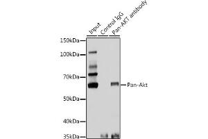 Immunoprecipitation analysis of 25 μg extracts of Rat brain cells using 3 μg Pan-Akt antibody (ABIN7265520). (AKT 1/2/3 Antikörper)