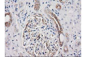 Immunohistochemical staining of paraffin-embedded Human Kidney tissue using anti-CDCP1 mouse monoclonal antibody. (CDCP1 Antikörper)