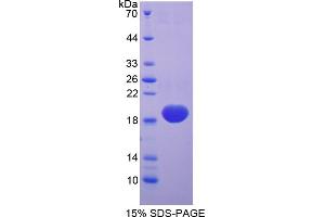 Image no. 1 for Superoxide Dismutase 1, Soluble (SOD1) (AA 2-154) protein (His tag) (ABIN6238003) (SOD1 Protein (AA 2-154) (His tag))