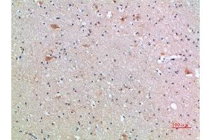 Immunohistochemistry (IHC) image for anti-Frizzled Family Receptor 9 (FZD9) (AA 1-50) antibody (ABIN7189401)