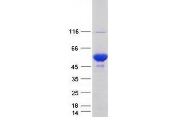 PRKAR1B Protein (Transcript Variant 6) (Myc-DYKDDDDK Tag)