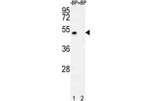 Western blot analysis of E2F1 antibody pre-incubated without (lane 1) and with (2) blocking peptide in 293T lysate.
