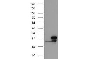 Image no. 1 for anti-NADH Dehydrogenase (Ubiquinone) 1 beta Subcomplex, 10, 22kDa (NDUFB10) antibody (ABIN1499671) (NDUFB10 Antikörper)