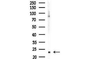 anti-GAR1 Ribonucleoprotein Homolog (Yeast) (GAR1) (Internal Region) antibody