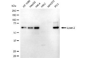 Western blotting analysis using epsin 2 antibody (ABIN7798488). (Epsin 2 Antikörper)