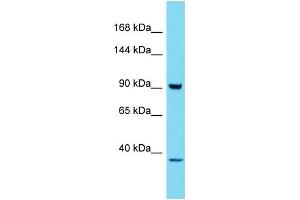 Host: Rabbit Target Name: HKDC1 Sample Type: 293T Whole Cell lysates Antibody Dilution: 1.