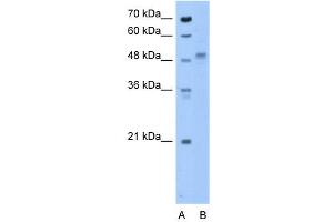 ZP4 antibody used at 0. (ZP4 Antikörper  (N-Term))