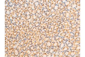 Immunohistochemistry (IHC) image for anti-Lamin A/C (LMNA) (pSer392) antibody (ABIN6256311)