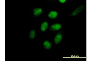 Immunofluorescence of purified MaxPab antibody to EED on HeLa cell. (EED Antikörper  (AA 1-441))