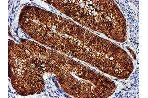 Image no. 8 for anti-Chromosome 1 Open Reading Frame 50 (C1ORF50) antibody (ABIN1497033)