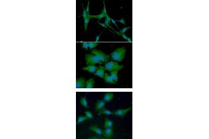 ICC/IF analysis of CTSS in U87MG cells line, stained with DAPI (Blue) for nucleus staining and monoclonal anti-human CTSS antibody (1:100) with goat anti-mouse IgG-Alexa fluor 488 conjugate (Green). (Cathepsin S Antikörper)