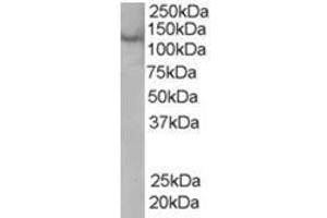 Image no. 1 for anti-Zinc Finger, FYVE Domain Containing 20 (ZFYVE20) (C-Term) antibody (ABIN374348) (Rabenosyn 5 Antikörper  (C-Term))