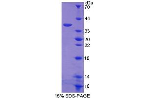 SDS-PAGE analysis of Human ERLIN2 Protein. (ERLIN2 Protein)