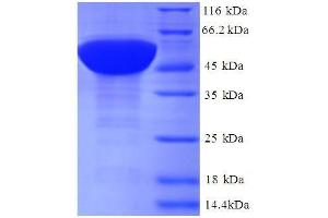 SDS-PAGE (SDS) image for Ribosomal Protein L17 (RPL17) (AA 2-184) protein (GST tag) (ABIN5712235)