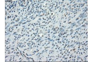 Immunohistochemical staining of paraffin-embedded colon tissue using anti-PRKAR1Amouse monoclonal antibody.