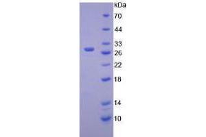 Image no. 1 for Hexosaminidase A (HEXA) (AA 319-528) (Active) protein (His tag) (ABIN5665811) (Hexosaminidase A Protein (HEXA) (AA 319-528) (His tag))