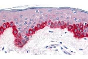 Immunohistochemistry of Apaf1 in human skin tissue with Apaf1 antibody at 20 μg/ml. (APAF1 Antikörper  (C-Term))