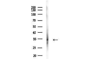 anti-Charged Multivesicular Body Protein 2A (CHMP2A) (Internal Region) antibody