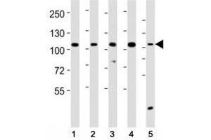 Western blot testing of LGR-5 antibody at 1:2000 dilution. (LGR5 Antikörper  (AA 689-719))