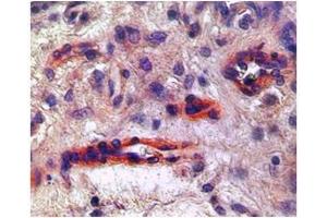 Immunohistochemistry (IHC) image for anti-VEGF Receptor 2 (VEGFR2) (N-Term) antibody (ABIN2792307)