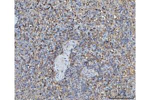 IHC analysis of TRMT61B using anti-TRMT61B antibody (ABIN7602334). (TRMT61B Antikörper  (AA 7-477))