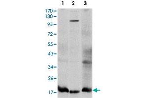 Western blot analysis using UBE2I monoclonal antobody, clone 1B10  against HeLa (1), HepG2 (2), and COS-7 (3) cell lysate.