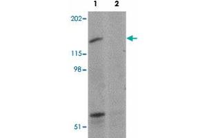 Western blot analysis of SYNPO2 in human skeletal muscle tissue lysate with SYNPO2 polyclonal antibody  at 1 ug/mL in (1) the absence and (2) the presence of blocking peptide.