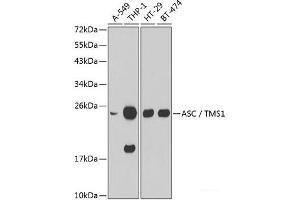 Western blot analysis of extracts of various cell lines using ASC / TMS1 Polyclonal Antibody.