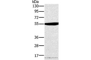 Western blot analysis of Hela cell , using OXCT1 Polyclonal Antibody at dilution of 1:300 (OXCT1 Antikörper)