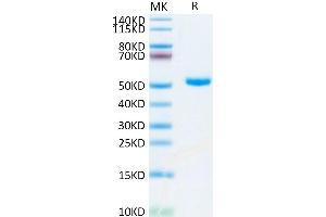 Human CD4 on Tris-Bis PAGE under reduced condition. (CD4 Protein (CD4) (AA 26-390) (His-Avi Tag))