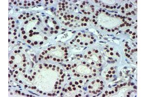 Image no. 13 for anti-Ubiquitin Specific Peptidase 7 (Herpes Virus-Associated) (USP7) antibody (ABIN1498592) (USP7 Antikörper)