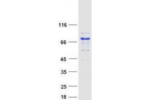 Validation with Western Blot (Adenylate Kinase 5 Protein (AK5) (Transcript Variant 2) (Myc-DYKDDDDK Tag))