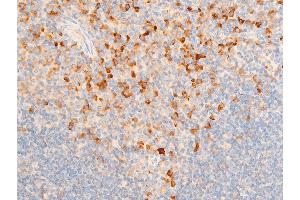 ABIN6267219 at 1/100 staining mouse spleen tissue sections by IHC-P. (NFKBIE Antikörper  (pSer161))