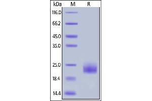 SDS-PAGE (SDS) image for Tumor Necrosis Factor Receptor Superfamily, Member 18 (TNFRSF18) (AA 23-154) (Active) protein (His tag) (ABIN6809886)