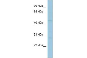 WB Suggested Anti-MAGEA10 Antibody Titration:  0. (MAGEA10 Antikörper  (Middle Region))