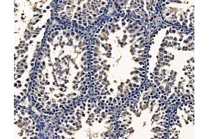 ABIN7095163 and ABIN7099219 at 1/100 staining mouse testis tissue by IHC-P. (METRN Antikörper)