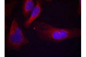 Immunofluorescence staining of methanol-fixed Hela cells using c-Cbl(phospho-Tyr700) Antibody. (CBL Antikörper  (pTyr770))