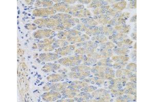 Immunohistochemistry of paraffin-embedded Mouse stomach using EFHC1 Polyclonal Antibody at dilution of 1:100 (40x lens). (EFHC1 Antikörper)
