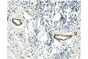 IHC analysis of CD146/MCAM using anti-CD146/MCAM antibody (ABIN7602098).