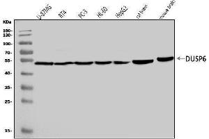 Western blot analysis of DUSP6 using anti-DUSP6 antibody (ABIN7599332).