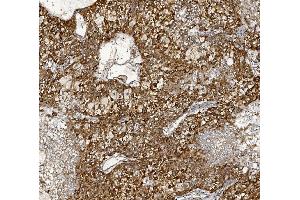 IHC analysis of MTTP using anti-MTTP antibody (ABIN7601145).