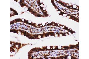 Immunohistochemistry (IHC) image for anti-Caspase 3 (CASP3) (AA 67-175) antibody (ABIN3030302)