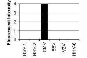 Cross Reactivity Results determined by IFA (CMV p65 Antikörper)