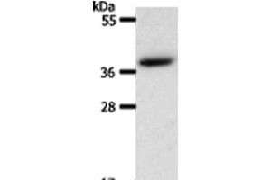 Western Blot analysis of Hela cell using AKR1B1 Polyclonal Antibody at dilution of 1:550 (AKR1B1 Antikörper)