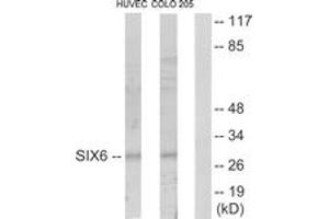 Western blot analysis of extracts from HuvEc/COLO205 cells, using SIX6 Antibody.
