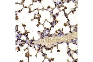 Immunohistochemistry of paraffin-embedded mouse lung using WHSC1 antibody (ABIN6128925, ABIN6150213, ABIN6150214 and ABIN6223939) at dilution of 1:100 (40x lens). (WHSC1 Antikörper  (AA 1-240))