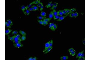 Immunofluorescent analysis of HepG2 cells using ABIN7151350 at dilution of 1:100 and Alexa Fluor 488-congugated AffiniPure Goat Anti-Rabbit IgG(H+L) (ART3 Antikörper  (AA 279-352))