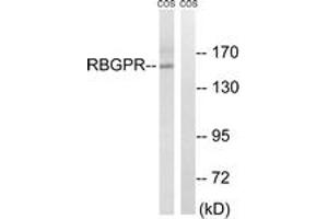 Western blot analysis of extracts from COS cells, using RAB3GAP2 Antibody. (RAB3GAP2 Antikörper  (AA 417-466))