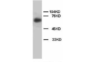 Image no. 2 for anti-Lamin B (AA 570-586) antibody (ABIN1493471) (Lamin B Antikörper  (AA 570-586))